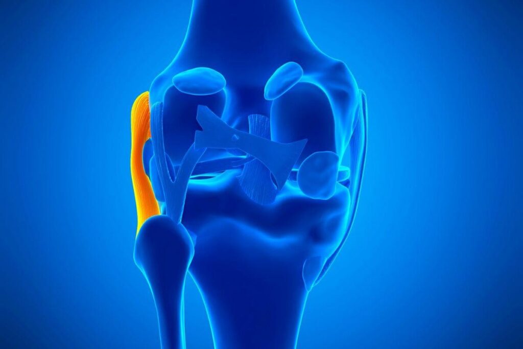 lesao-ligamento-colateral-lateral-dr-lucas-cordeiro-ortopedista-joelho-sao-paulo