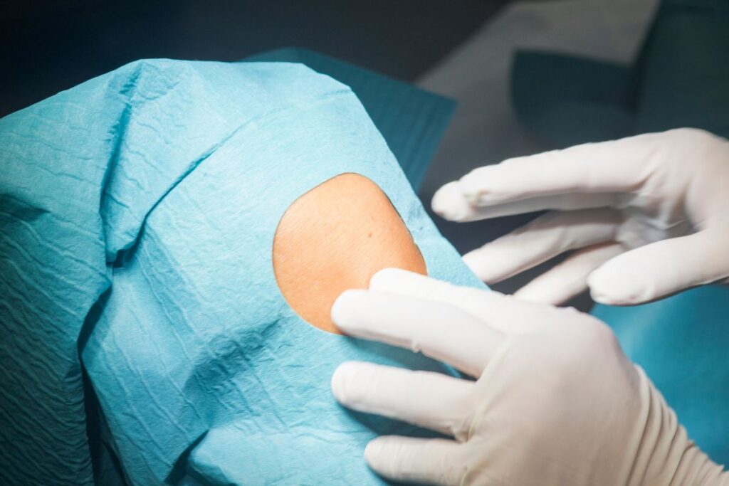 lesao-ligamento-colateral-medial-tratamento-dr-lucas-cordeiro-ortopedista-joelho-são-paulo