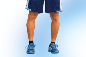 joelho-varo-dr-lucas-cordeiro-ortopedista-joelho-sao-paulo